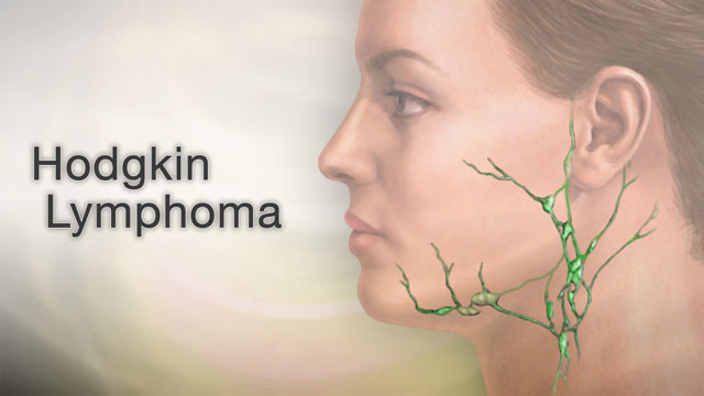 back neck lymph nodes swollen